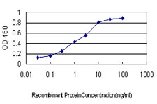 GTF2I / TFII I Antibody - Detection limit for recombinant GST tagged GTF2I is approximately 0.03 ng/ml as a capture antibody.