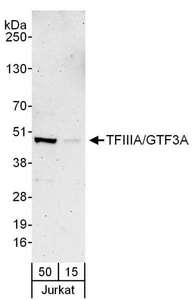 GTF3A Antibody - Detection of Human TFIIIA/GTF3A by Western Blot. Samples: Whole cell lysate (15 and 50 ug) from Jurkat cells. Antibodies: Affinity purified rabbit anti-TFIIIA/GTF3A antibody used for WB at 0.4 ug/ml. Detection: Chemiluminescence with an exposure time of 3 minutes.