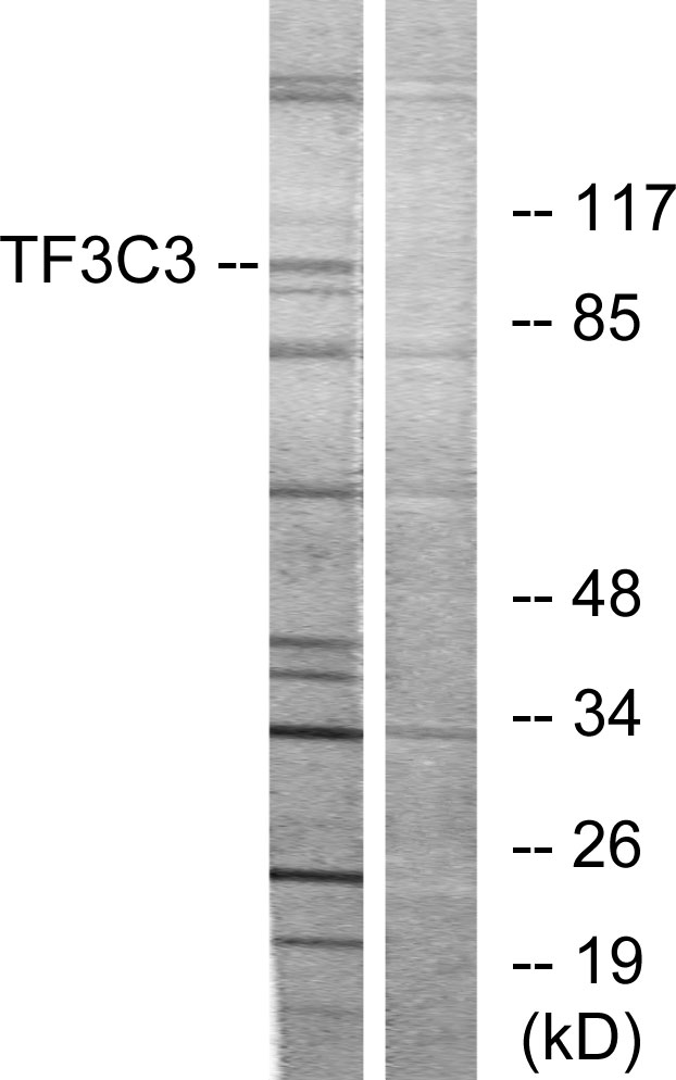 GTF3C3 Antibody - Western blot analysis of lysates from 293 cells, using TF3C3 Antibody. The lane on the right is blocked with the synthesized peptide.