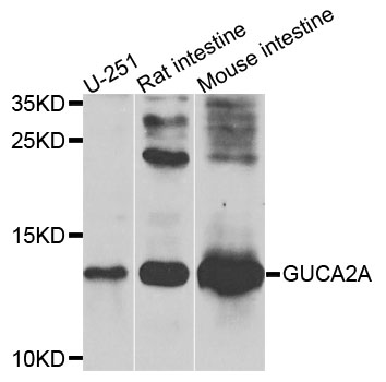 GUCA2A / Guanylin Antibody - Western blot analysis of extracts of various cells.