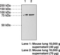 GUCY1A1 / GUCY1A3 Antibody - Western blot of GUCY1A1 / GUCY1A3 antibody.