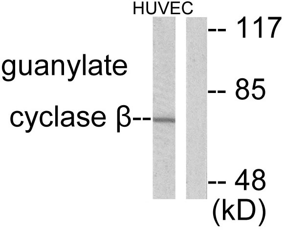 GUCY1B3 Antibody - Western blot analysis of lysates from HUVEC cells, using Guanylate Cyclase beta Antibody. The lane on the right is blocked with the synthesized peptide.