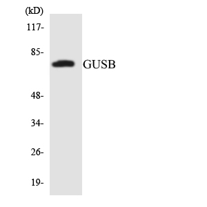 GUSB / Beta Glucuronidase Antibody - Western blot analysis of the lysates from COLO205 cells using GUSB antibody.