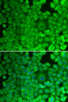 GYS1 / Glycogen Synthase Antibody - Immunofluorescence analysis of HeLa cell using GYS1 antibody. Blue: DAPI for nuclear staining.