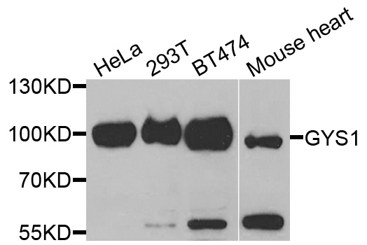 GYS1 / Glycogen Synthase Antibody - Western blot analysis of extracts of various cells.