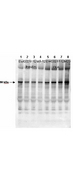 GYS1 / Glycogen Synthase Antibody - Anti-Muscle Glycogen Synthase pS640 Antibody - Western Blot. Affinity Purified Phospho-specific antibody to human muscle Glycogen Synthase (GS) at pS640 was used at a 1:1000 dilution to detect human muscle GS by Western blot. Approximately 12 ul of a mouse cardiac myocyte lysate was loaded per lane on a 4-20% Criterion gel for SDS-PAGE. Samples were either mock treated (lanes 1 and 5) or insulin treated at 10 nM, 100 nM and 1 um (lanes 2, 3 and 4 respectively) for 15 or CLA treated at 4nM, 20 nM or 100 nM (lanes 6,7 and 8 respectively) for 45. After washing, a 1:5000 dilution of HRP conjugated Gt-a-Rabbit IgG (LS-C60865) preceded color development using Amershams substrate system. Other detection methods will yield similar results.