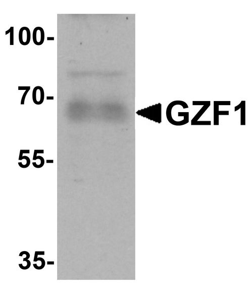 GZF1 Antibody - Western blot analysis of GZF1 in human heart tissue lysate with GZF1 antibody at 1 ug/ml.