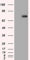 H6PD / G6PDH Antibody - HEK293T cells were transfected with the pCMV6-ENTRY control (Left lane) or pCMV6-ENTRY H6PD (Right lane) cDNA for 48 hrs and lysed. Equivalent amounts of cell lysates (5 ug per lane) were separated by SDS-PAGE and immunoblotted with anti-H6PD.