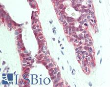 HACD1 / PTPLA Antibody - Anti-PTPLA antibody IHC staining of human breast. Immunohistochemistry of formalin-fixed, paraffin-embedded tissue after heat-induced antigen retrieval. Antibody dilution 1:100.