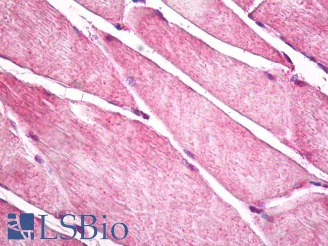 HACL1 Antibody - Anti-HACL1 antibody IHC of human skeletal muscle. Immunohistochemistry of formalin-fixed, paraffin-embedded tissue after heat-induced antigen retrieval. Antibody dilution 5 ug/ml.