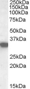 HADH Antibody - SCHAD / HADHSC Antibody (0.02 ug/ml) staining of Human Kidney lysate (35 ug protein in RIPA buffer). Primary incubation was 1 hour. Detected by chemiluminescence.