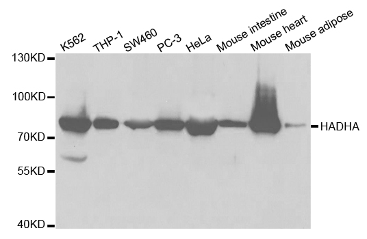 HADHA Antibody - Western blot analysis of extracts of various cell lines.