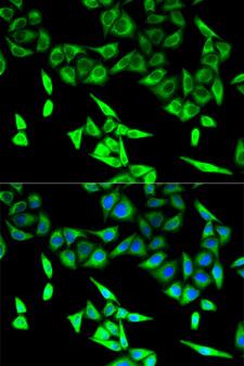 HADHA Antibody - Immunofluorescence analysis of U2OS cells.