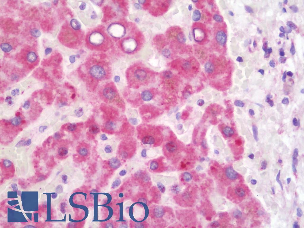 HADHB Antibody - Anti-HADHB antibody IHC staining of human liver. Immunohistochemistry of formalin-fixed, paraffin-embedded tissue after heat-induced antigen retrieval. Antibody concentration 10 ug/ml.  This image was taken for the unconjugated form of this product. Other forms have not been tested.