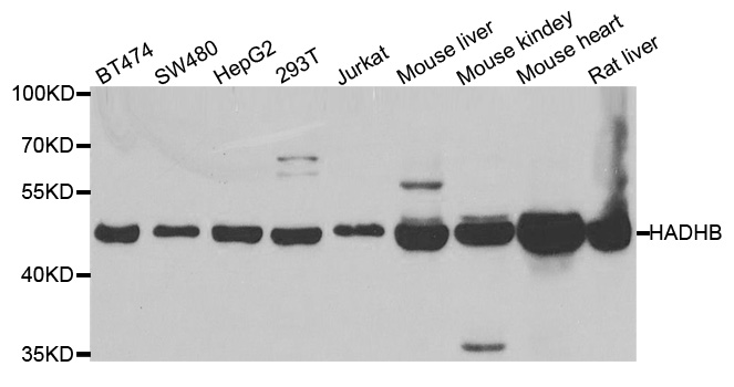 HADHB Antibody - Western blot analysis of extracts of various cell lines, using HADHB antibody.