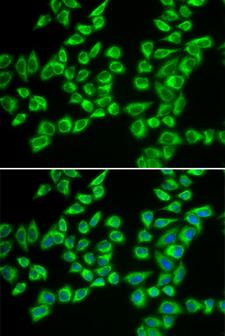 HADHB Antibody - Immunofluorescence analysis of A549 cells.