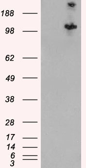 Hamartin / TSC1 Antibody - HEK293 overexpressing Human TSC1 (RC213332) and probed with (mock transfection in first lane).