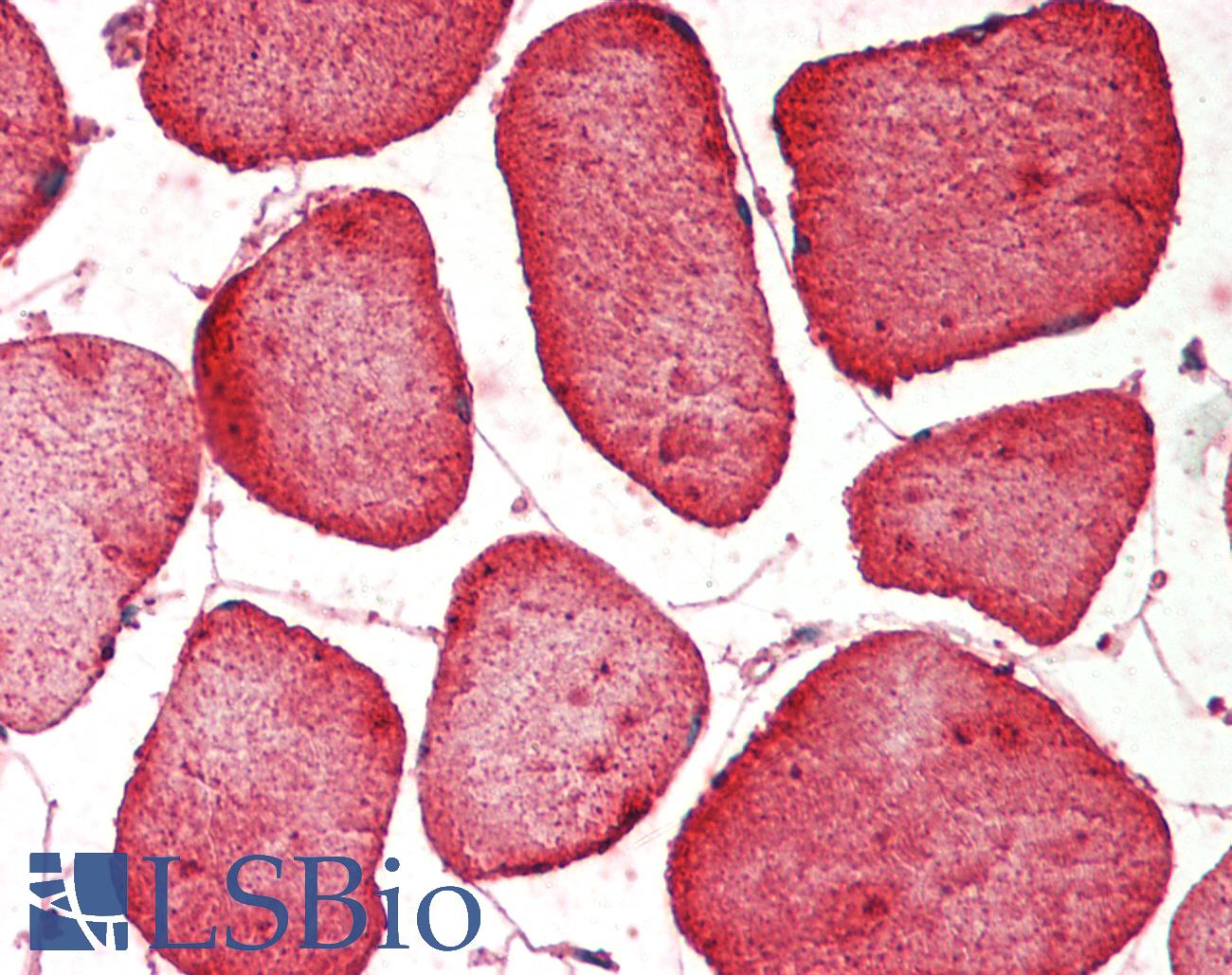 Hamartin / TSC1 Antibody - Human Skeletal Muscle: Formalin-Fixed, Paraffin-Embedded (FFPE)