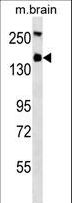 Hamartin / TSC1 Antibody - TSC1 Antibody western blot of mouse brain tissue lysates (35 ug/lane). The TSC1 antibody detected the TSC1 protein (arrow).