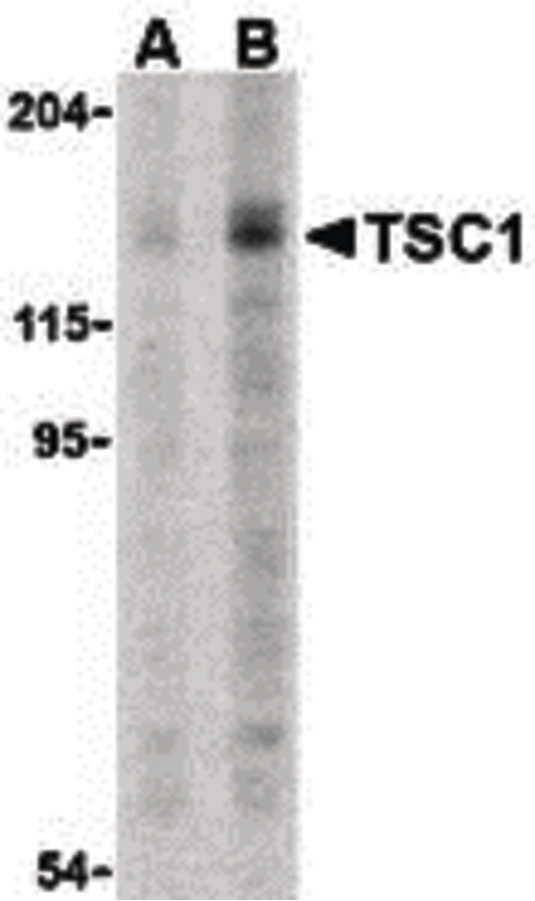 Hamartin / TSC1 Antibody - Western blot of TSC1 in C2C12 cell lysate with TSC1 antibody at (A) 2 and (B) 4 ug.