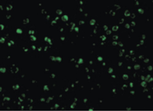 Hamartin / TSC1 Antibody - Immunofluorescence of TSC1 in L1210 cells with TSC1 antibody at 10 ug/ml.