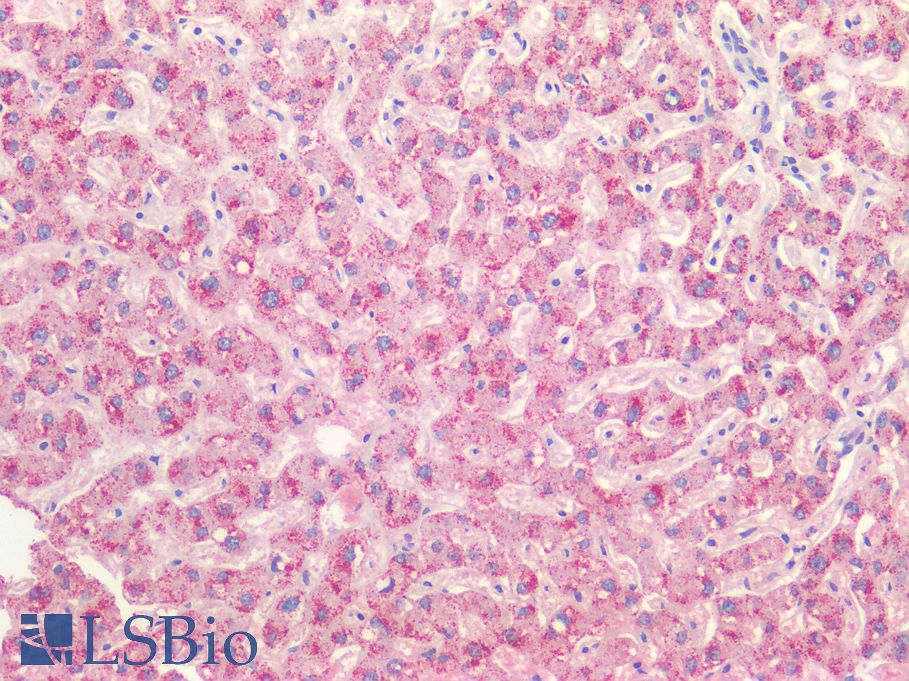 HAO1 Antibody - Human Liver: Formalin-Fixed, Paraffin-Embedded (FFPE)
