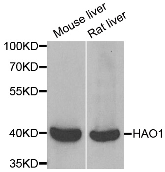 HAO1 Antibody - Western blot analysis of extracts of various cell lines.