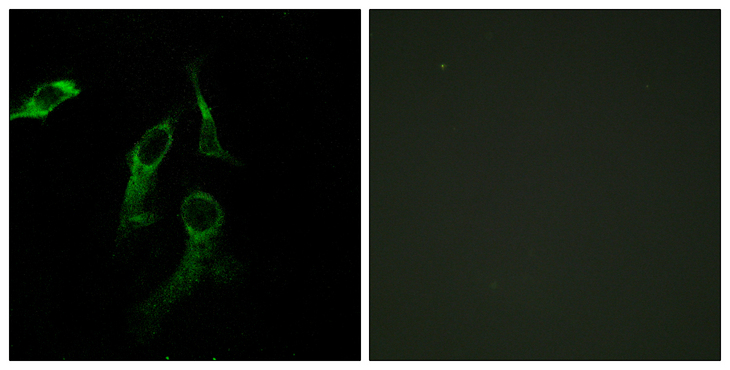 HARS Antibody - Immunofluorescence analysis of HepG2 and HeLa cells, using HARS Antibody. The picture on the right is blocked with the synthesized peptide.