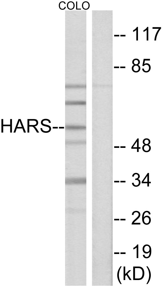 HARS Antibody - Western blot analysis of lysates from COLO cells, using HARS Antibody. The lane on the right is blocked with the synthesized peptide.