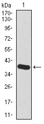 HAS2 Antibody - Western blot using HAS2 monoclonal antibody against human HAS2 recombinant protein. (Expected MW is 37.5 kDa)