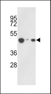 HAT1 Antibody - Western blot of hHAT1-E404 in 293, HepG2, Jurkat cell line lysates (35 ug/lane). HAT1 (arrow) was detected using the purified antibody.