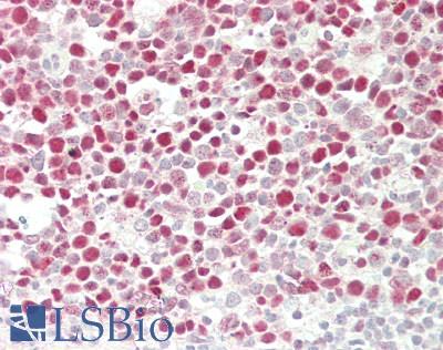 HAT1 Antibody - Human Tonsil: Formalin-Fixed, Paraffin-Embedded (FFPE)