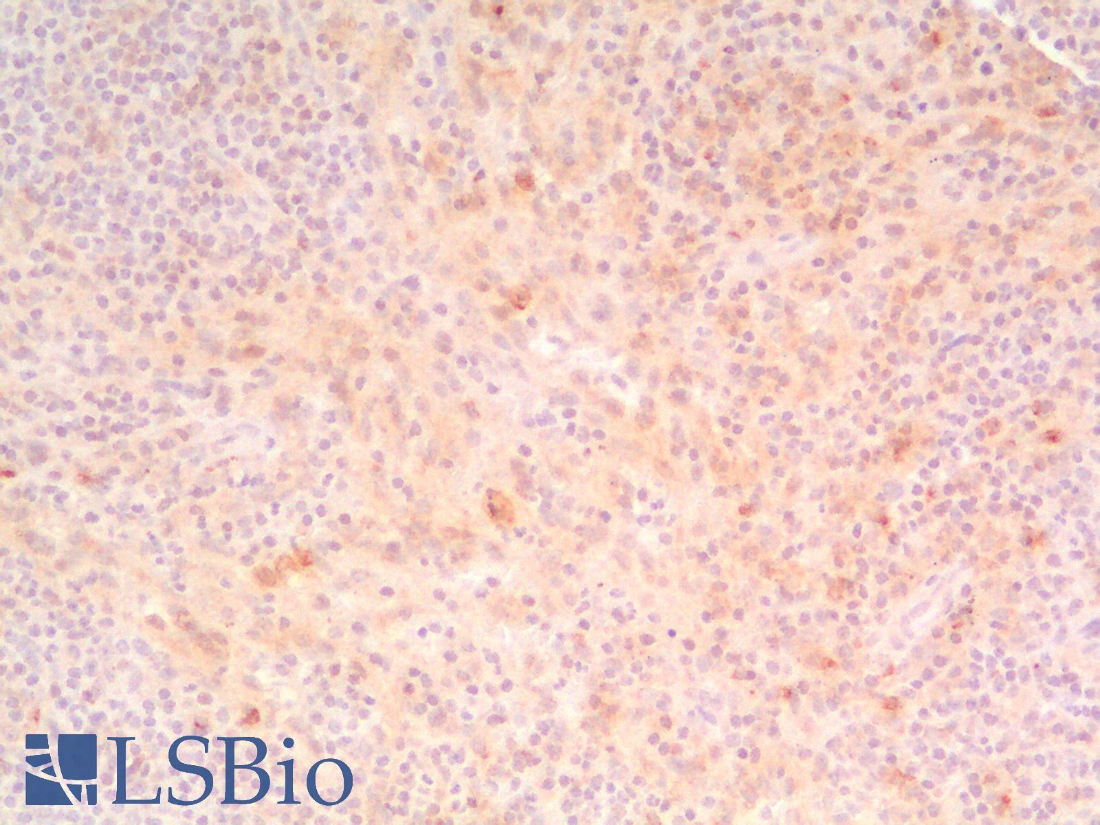 HAVCR2 / TIM-3 Antibody - Human Spleen: Formalin-Fixed, Paraffin-Embedded (FFPE)