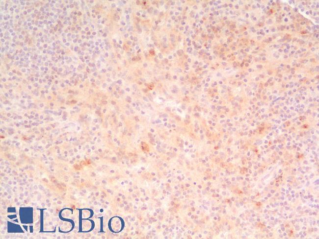 HAVCR2 / TIM-3 Antibody - Human Spleen: Formalin-Fixed, Paraffin-Embedded (FFPE)