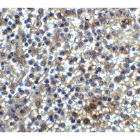HAVCR2 / TIM-3 Antibody - Immunohistochemistry of TIM3 in human spleen tissue with TIM3 antibody at 2 µg/ml.