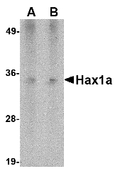 HAX-1 Antibody - Western blot of Hax1a in human heart tissue lysate with Hax1a antibody at (A) 1 and (B) 2 ug/ml