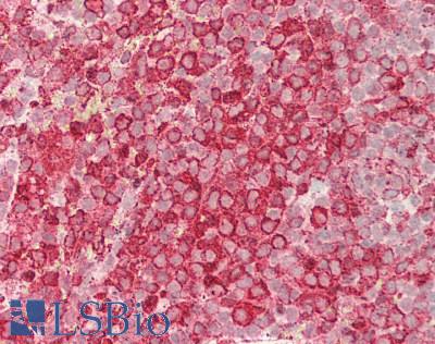 HAX-1 Antibody - Human Spleen: Formalin-Fixed, Paraffin-Embedded (FFPE)