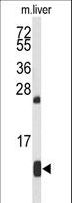 HBA1+2 / Hemoglobin Alpha Antibody - Western blot of HBA2 Antibody in mouse liver tissue lysates (35 ug/lane). HBA2 (arrow) was detected using the purified antibody.
