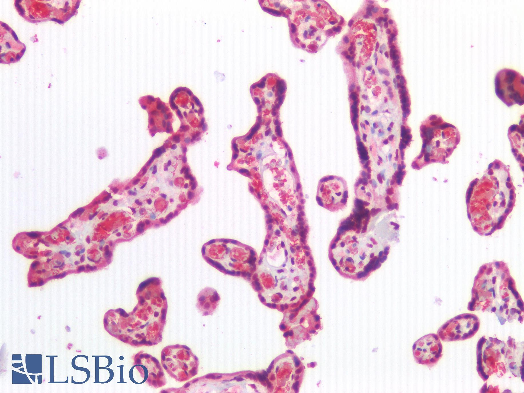 HBA2 / Hemoglobin Alpha 2 Antibody - Human Placenta: Formalin-Fixed, Paraffin-Embedded (FFPE)