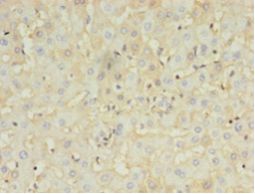 HBB / Hemoglobin Beta Antibody - Immunohistochemistry of paraffin-embedded human liver using antibody at 1:100 dilution.  This image was taken for the unconjugated form of this product. Other forms have not been tested.