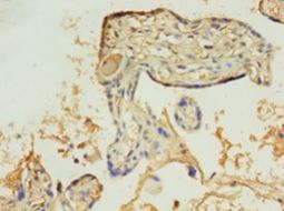 HBB / Hemoglobin Beta Antibody - Immunohistochemistry of paraffin-embedded human placenta tissue using antibody at 1:100 dilution.  This image was taken for the unconjugated form of this product. Other forms have not been tested.