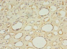 HBB / Hemoglobin Beta Antibody - Immunohistochemistry of paraffin-embedded human kidney tissue using antibody at 1:100 dilution.  This image was taken for the unconjugated form of this product. Other forms have not been tested.