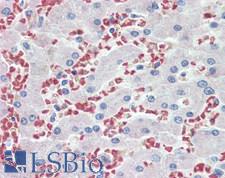 HBB / Hemoglobin Beta Antibody - Human Liver: Formalin-Fixed, Paraffin-Embedded (FFPE), at a concentration of 10 ug/ml. 
