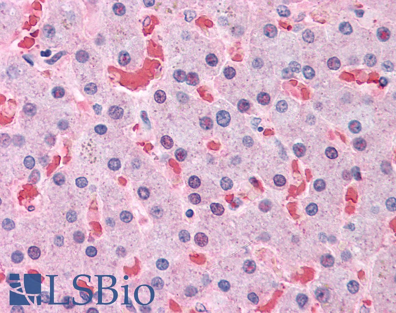 HBB / Hemoglobin Beta Antibody - Anti-HBB antibody IHC of human liver. Immunohistochemistry of formalin-fixed, paraffin-embedded tissue after heat-induced antigen retrieval. Antibody concentration 5 ug/ml.