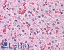 HBB / Hemoglobin Beta Antibody - Anti-HBB antibody IHC of human liver. Immunohistochemistry of formalin-fixed, paraffin-embedded tissue after heat-induced antigen retrieval. Antibody concentration 5 ug/ml.