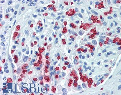 HBB / Hemoglobin Beta Antibody - Human Kidney: Formalin-Fixed, Paraffin-Embedded (FFPE)