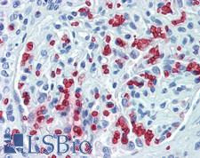 HBB / Hemoglobin Beta Antibody - Human Kidney: Formalin-Fixed, Paraffin-Embedded (FFPE)