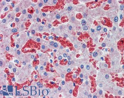 HBB / Hemoglobin Beta Antibody - Human Liver: Formalin-Fixed, Paraffin-Embedded (FFPE)