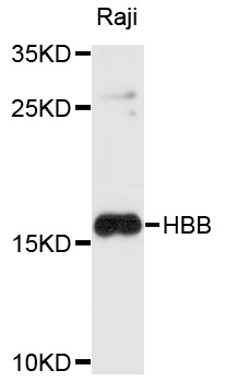 HBB / Hemoglobin Beta Antibody - Western blot analysis of extracts of Raji cells, using HBB antibody at 1:1000 dilution. The secondary antibody used was an HRP Goat Anti-Rabbit IgG (H+L) at 1:10000 dilution. Lysates were loaded 25ug per lane and 3% nonfat dry milk in TBST was used for blocking. An ECL Kit was used for detection and the exposure time was 10s.