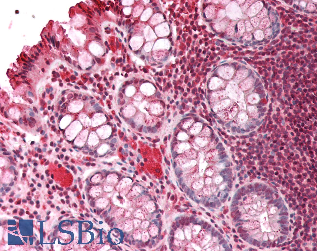 HBXIP Antibody - Human Colon: Formalin-Fixed, Paraffin-Embedded (FFPE)